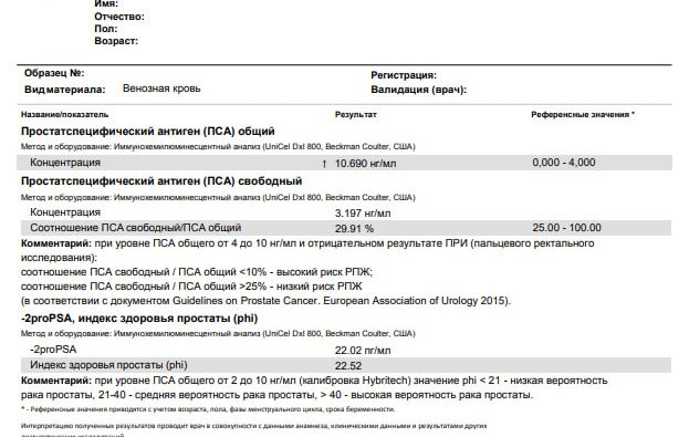 PROSTATE CANCER RUSSIA