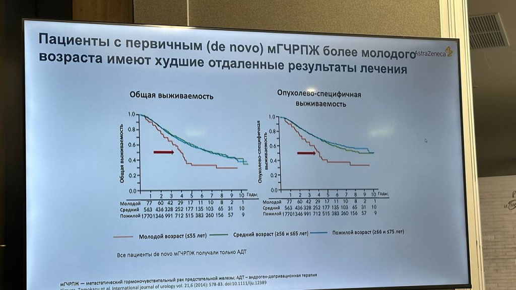 PROSTATE CANCER RUSSIA